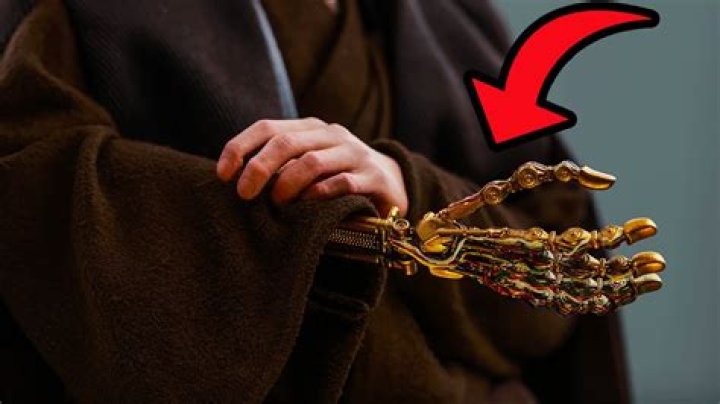 Did Anakin have fake arm?