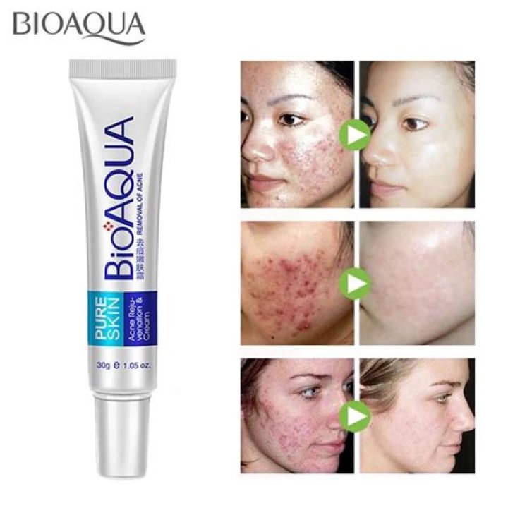 How do you use Bioaqua anti acne cream?
